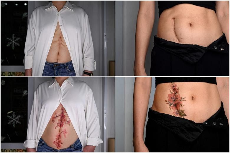 Scar tissue: Vietnamese women find healing with tattoos